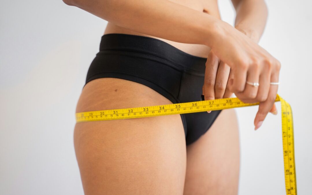 What Happens to Your Body After Liposuction?