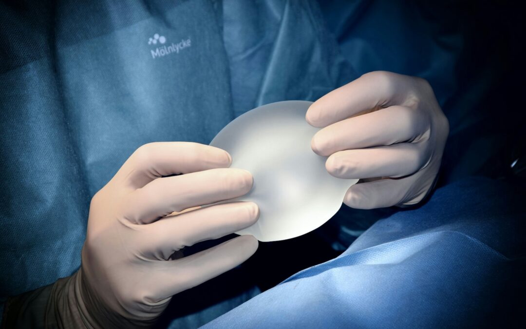 Do Breast Implants Really Need to Be Replaced Every 10 Years?