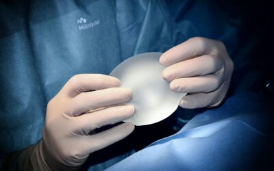 Do Breast Implants Really Need to Be Replaced Every 10 Years?
